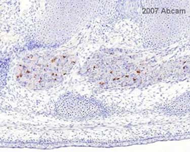 ab2302 at 1/50 staining mouse embryo (day 16) tissue sections by IHC-P. The tissue was formaldehyde fixed and a heat mediated antigen retrieval step was performed in citric acid. The tissue was then blocked and incubated with the antibody for 1 hour. A biotinylated goat anti-rabbit antibody was used as the secondary. The image shows an E16 mouse body parasaggital sections showinf DRGs in the lumbar/sacral region of the spinal column (there is highest apoptotic index in the organ at this age).See Abreview