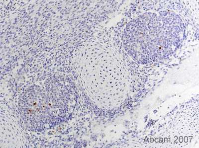 Immunohistochemistical detection (on formaldehyde/PFA-fixed paraffin-embedded sections) of active Caspase-3 antibody (ab2302) on Quail Tissue sections (Quail E6/7 developing DRGs Saggital section). Antigen retrieval step: Heat mediated. Blocking step: 1% BSA for 10 mins RT. Primary Antibody ab2302 incubated at 1/50 for at RT. Secondary Antibody: Biotin conjugated goat anti rabbit IgG (1/300).