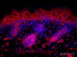 ab14123 staining mouse embryonic skin tissue sections by IHC-P.  Sections were PFA fixed and subjected to heat mediated antigen retrieval in citrate buffer prior to blocking with a commercially available (mouse-on-mouse) blocking reagent for 1 hour at RT.  The primary antibody was diluted 1/50 and incubated with the sample for 24 hours at 4°C.   A biotinylated mouse anti-mouse antibody was used as the secondary, followed by a Streptavidin-Cy3®.  See Abreview