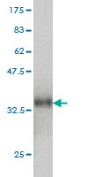 Western blot against tagged recombinant protein immunogen using ab55752 CCL14 antibody at 1ug/ml.