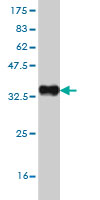 Western blot against tagged recombinant protein immunogen using ab57804 CCL4L2 antibody at 1ug/ml.