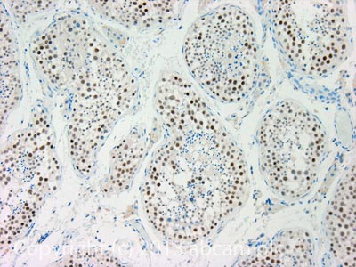 IHC image of CCNK staining in Human normal testis formalin fixed paraffin embedded tissue section, performed on a Leica BondTM system using the standard protocol F. The section was pre-treated using heat mediated antigen retrieval with sodium citrate buffer (pH6, epitope retrieval solution 1) for 20 mins. The section was then incubated with ab85854, 5µg/ml, for 15 mins at room temperature and detected using an HRP conjugated compact polymer system. DAB was used as the chromogen. The section was then counterstained with haematoxylin and mounted with DPX.For other IHC staining systems (automated and non-automated) customers should optimize variable parameters such as antigen retrieval conditions, primary antibody concentration and antibody incubation times.