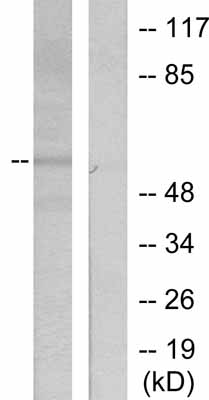 All lanes : Anti-CCNL1 antibody (ab53045) at 1/500 dilutionLane 1 : HepG2 cell extractLane 2 : HepG2 cell extract with immunising peptide