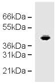 Anti-CCR1 antibody (ab19013) at 1 µg/ml + A357 cell lysate