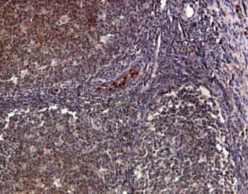 ab1681, at a dilution of 1/300, staining CCR1 in human tonsil section by Immunohistochemistry (Formalin/PFA-fixed paraffin-embedded sections).