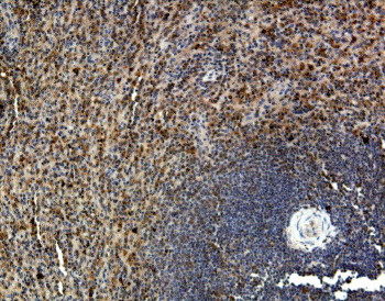 ab1681, at a dilution of 1/300, staining CCR1 in human spleen section by Immunohistochemistry (Formalin/PFA-fixed paraffin-embedded sections).