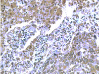 Immunohistochemistry using ab1660 on human lung tissue section 