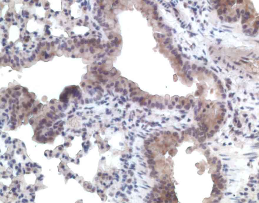 Immunohistochemistry using ab1660 on human lung tissue section