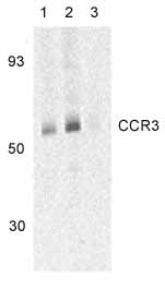 Lane 1 :  Anti-CCR3 antibody (ab36827) at 1 µg/mlLanes 2 - 3 :  Anti-CCR3 antibody (ab36827) at 2 µg/mlLane 1 : Human spleen tissue lysates Lane 2 : Human spleen tissue lysates Lane 3 : Human spleen tissue lysates with Blocking peptide 