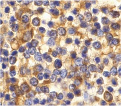 ab36827 at 10µg/ml staining CCR3 in human spleen tissue by IHC 