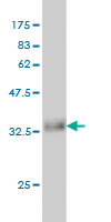 Western blot against tagged recombinant protein immunogen using ab54953 Activin A Receptor Type IB antibody at 1ug/ml.