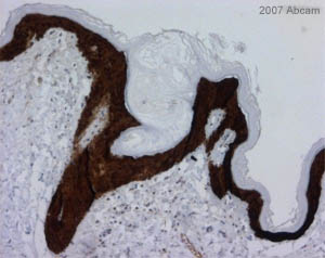 ab14123 at 1/50 staining human epithelium tissue sections by Immunohistochemistry (Formalin/PFA-fixed paraffin-embedded sections). The tissue was paraformaldehyde fixed and a heat mediated antigen retrieval step was performed. The tissue was incubated with the antibody for 30 minutes. An HRP conjugated goat polyclonal antibody was used as the secondary.See Abreview