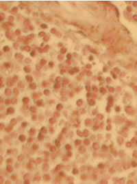 Immunohistochemistry using ab1669 on a section of human spleen.