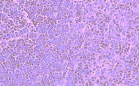 Immunohistochemistry using ab1673 on a section of normal human spleen