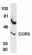 Anti-CCR5 antibody (ab7346) at 1/1000 dilution + THP-1 whole cell lysateObserved band size : 40 kDa (why is the actual band size different from the predicted?)
