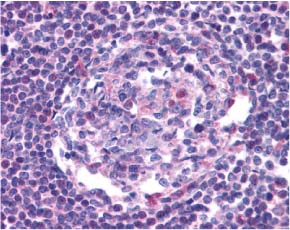 ab7346 at 20µg/ml staining CCR5 in human lymph node tissue by IHC