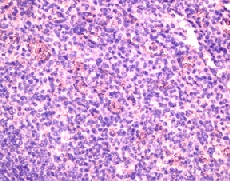 Immunohistochemistry on paraffin section of human spleen, at 1/250 dilution.
