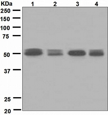 All lanes : Anti-Activin A Receptor Type IB antibody [EPR4816] (ab133478) at 1/10000 dilutionLane 1 : HepG2 cell lysateLane 2 : SH SY5Y cell lysateLane 3 : U87 MG cell lysateLane 4 : 293T cell lysateLysates/proteins at 10 µg per lane.SecondaryHRP labelled goat anti-rabbit at 1/2000 dilution