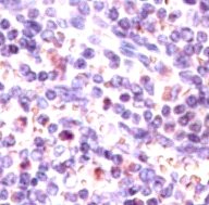 Immunohistochemical staining for CCR7 in human spleen.