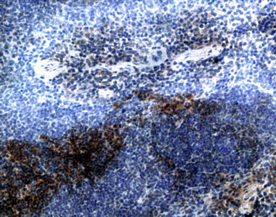 ab1657, at a dilution of 1/250, staining CCR7 in mouse spleen section by Immunohistochemistry (Formalin/PFA-fixed paraffin-embedded sections).