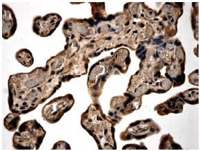 ab78415 at 1/50 dilution, staining Activin A Receptor Type IB in human placental tissue section by Immunohistochemistry (Formalin/PFA fixed paraffin-embedded sections).