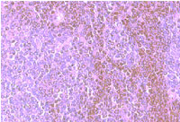 Immunohistochemistry using ab1666 on a paraffin section of human spleen.