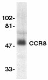 Anti-CCR8 antibody (ab8019) at 1/500 dilution + human spleen lysateObserved band size : 50 kDa (why is the actual band size different from the predicted?)