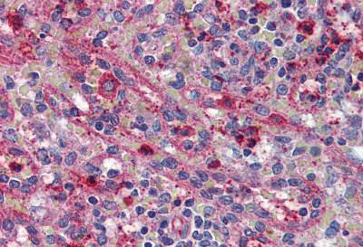 Immunohistochemical analysis of formalin-fixed, paraffin-embedded Human spleen tissue labelling Activin A Receptor Type IC with ab140705 at 5 µg/ml.