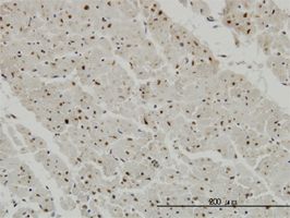 CCRK antibody (ab57157) used in immunohistochemistry at 3ug/ml on formalin fixed and paraffin embedded human heart.