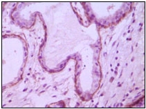 Immunohistochemical analysis of paraffin-embedded human breast ductal myoepithelium showing cytoplasmic localization using ab47721 at a 1/100 dilution, with DAB staining.