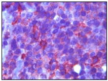 Immunohistochemical analysis of paraffin-embedded human lymph tissue showing membrane localization using ab47721 at a 1/100 dilution, with DAB staining and AEC.
