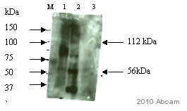 All lanes : Anti-Activin antibody [MM0074-7L18] (ab89307) at 1 µg/mlLane 1 : Embryonic Day 18 LiverLane 2 : Embryonic Day 18 MusclesLane 3 : Embryonic Day 18 Cortex (Negative Control)developed using the ECL techniquePerformed under reducing conditions.