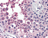 ab115301, at 4 µg/ml, staining Activin Receptor Type IA in formalin-fixed, paraffin-embedded Human Testis by Immunohistochemistry, using a biotinylated anti-goat IgG secondary antibody, alkaline phosphatase-streptavidin and chromogen.