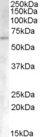 Anti-Activin Receptor Type IA antibody (ab115301) at 0.3 µg/ml + Human Umbilical Cord lysate (in RIPA buffer) at 35 µgdeveloped using the ECL technique