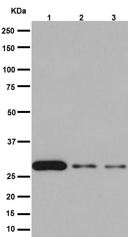 All lanes : Anti-14-3-3 sigma antibody [EPR5873(2)] (ab193667) at 1/1000 dilutionLane 1 : Human skin lysateLane 2 : A431 cell lysateLane 3 : HACAT cell lysateLysates/proteins at 20 µg per lane.SecondaryGoat Anti-Rabbit IgG, (H+L), Peroxidase conjugated at 1/1000 dilution