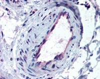 ab117242, at 10 µg/ml, staining Activin Receptor Type IA in Formalin-fixed, Paraffin-embedded Human Skeletal muscle vessel tissue by Immunohistochemistry followed by biotinylated secondary antibody, alkaline phosphatase-streptavidin and chromogen.