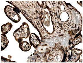 ab78414 at 1/50 dilution, staining Activin Receptor Type IA in human placental tissue section by Immunohistochemistry (Formalin/PFA fixed paraffin-embedded sections).