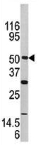 Anti-Activin Receptor Type IA antibody - N-terminal (ab135633) at 1/100 dilution + Mouse brain tissue lysate at 12.5 µg
