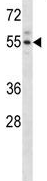 Anti-Activin Receptor Type IIA antibody (ab124072) at 1/100 dilution + Mouse kidney tissue lysate at 35 µg