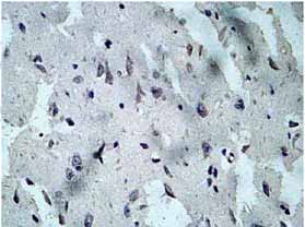 ab128544, at a dilution of 1/100, staining Activin Receptor Type IIB in paraffin-embedded Human fetal brain tissue by Immunohistochemistry.
