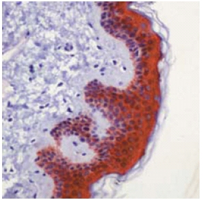 ab53913 staining 14-3-3 sigma in human skin tissue; formalin fixed, paraffin embedded section.
