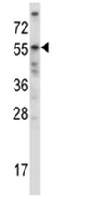 Anti-Activin Receptor Type IIB antibody (ab116315) at 1/100 dilution + NCI-H460 cell line lysates at 35 µg