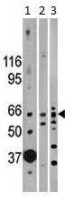 All lanes : Anti-Activin Receptor Type IIB antibody - N-terminal (ab135635) at 1/100 dilutionLane 1 : Mouse heart lysatesLane 2 : Mouse kidney lysatesLane 3 : Mouse brain lysatesLysates/proteins at 35 µg per lane.