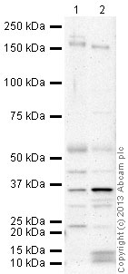 All lanes : Anti-CD163 antibody (ab87099) at 2 µg/ml (3% milk)Lane 1 : Thymus (Human) Tissue Lysate - adult normal tissue (ab30146)Lane 2 : Spleen (Human) Tissue Lysate - adult normal tissue (ab29699)Lysates/proteins at 20 µg per lane.SecondaryGoat Anti-Rabbit IgG H&L (HRP) (ab97051) at 1/10000 dilutiondeveloped using the ECL techniquePerformed under reducing conditions.