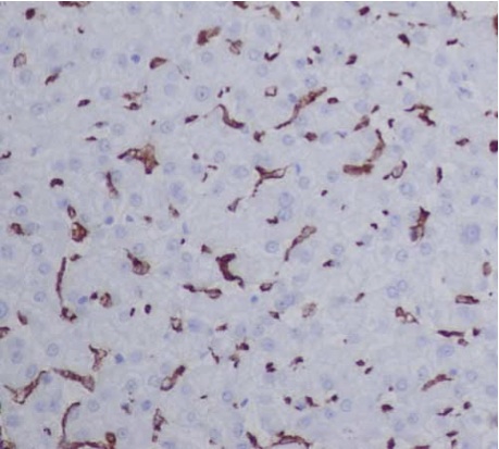 Immunohistochemical analysis of paraffin-embedded Human liver tissue labeling CD163 with ab188571 at 1/500. A prediluted HRP Polymer for Rabbit IgG was use as the secondary antibody.