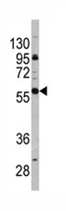 Anti-CD19 antibody (ab76591) at 1/60 dilution + Jurkat cell line lysates at 35 µg