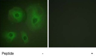 Immunofluorescence analysis of HeLa cells using ab63630 at a dilution of 1/500-1/1000. Samples were untreated (left hand panel) or treated (right hand panel) with the immunizing peptide.