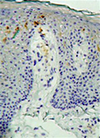 Ab708 positively staining acetone fixed, frozen human skin sections (1/25). The secondary Ab used was biotin conjugated anti mouse (1/1) and formed part of of a commercially available kit (Vector labs RTU ABC kit).This image is courtesy of an Abreview submitted on 11 October 2005. We do not have any further information relating to this image.