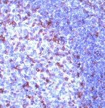 Ab37212 staining human CD2 in tonsil by immunohistochemistry, Formalin fixed Paraffin embedded tissue.