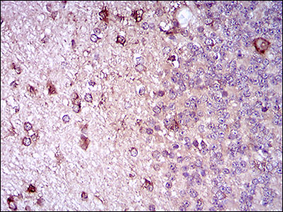Immunohistochemical analysis of paraffin-embedded Human cerebellum tissue labeling CD22 with ab181771 at 1/200 dilution followed by DAB staining.